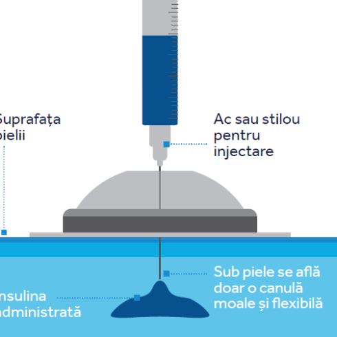 i-Port Advance™ (cutie cu 10 porturi)  administrarea usoara si confortabila a insulinei