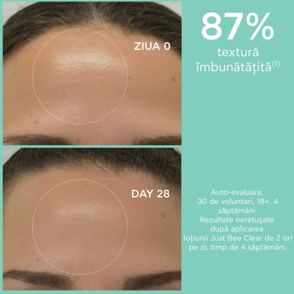 lotiune purifianta just bee clear pentru pori dilatati cu 2 aha 200ml apivita 813056